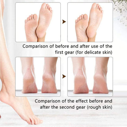 REMOVEDOR DE CALLO ELÉCTRICO BD613